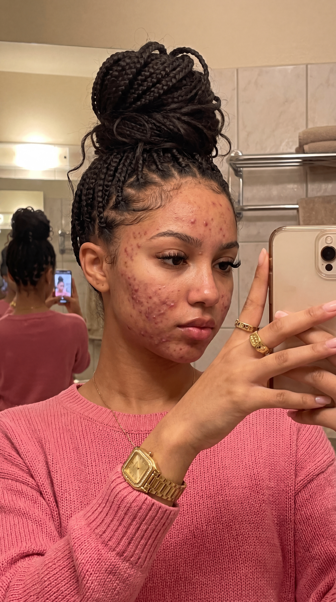 Skin before the Koec routine — thandi